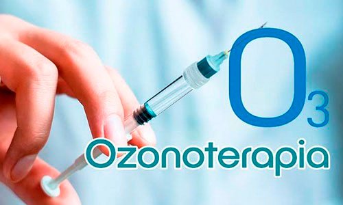 ozonoterapia